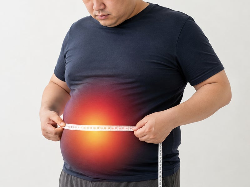비만이 유발하는 4가지 합병증 사진 2